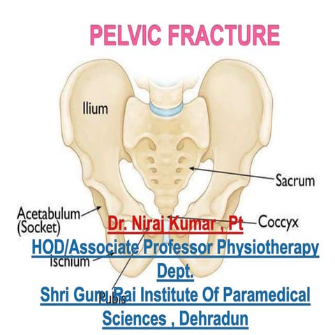 Pelvic fracture