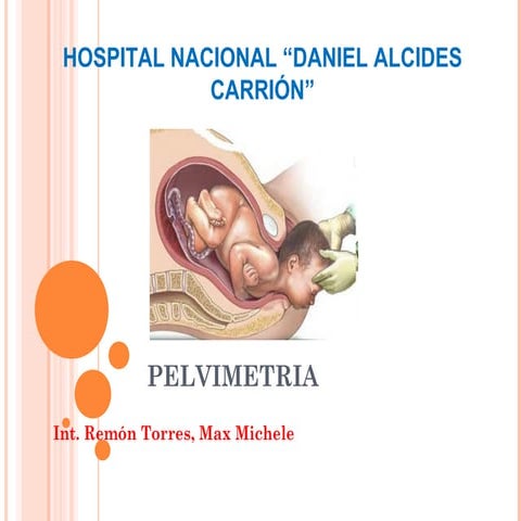 Pelvimetria y Diametros Fetales | PPTX