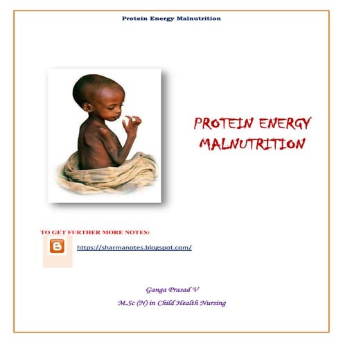 Protein Energy Malnutrition