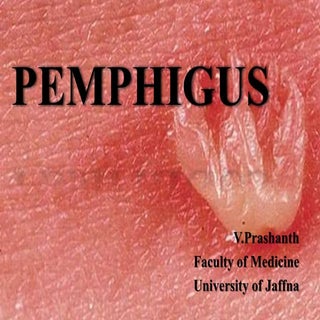 Pemphigus (Bullous Disease)