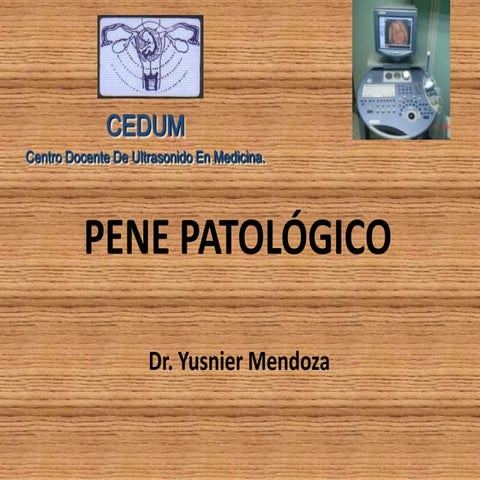 Ecografia de Pene patológico