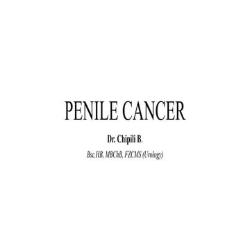 THE MANAGEMENT OF PENILE CANCER. PowerPoint