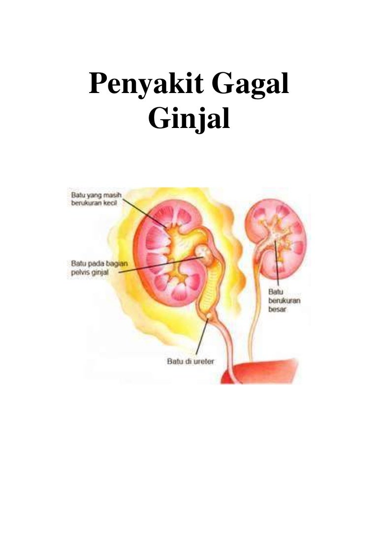 Penyakit Gagal Ginjal Hipertensi