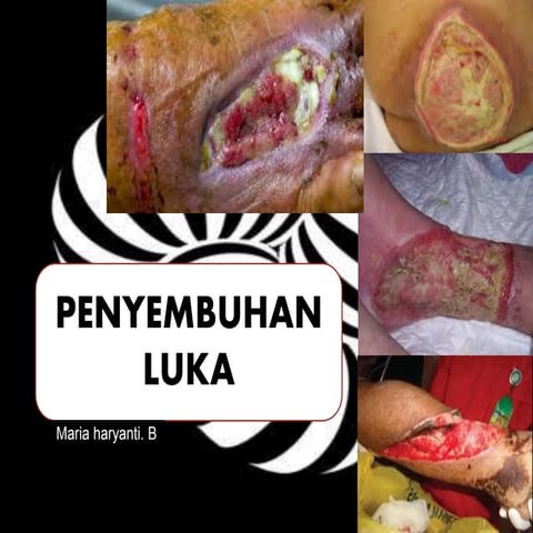 Penyembuhan luka part 1