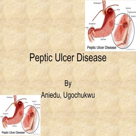 Peptic ulcer