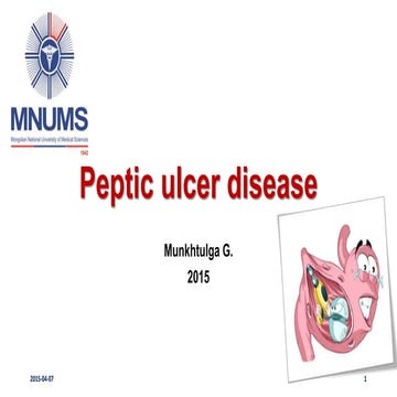 Peptic ulcer disease, upper gastrointestinal tract bleeding management