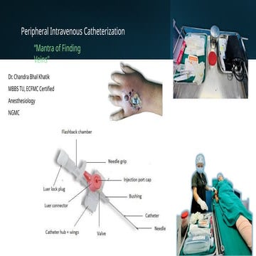 Peripheral IV Catheterization: Practical Guide by Dr. Chandra Bhal Khatik, Dr...