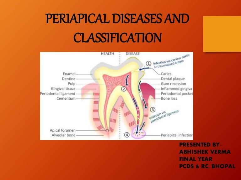 Periapical diseases and classification