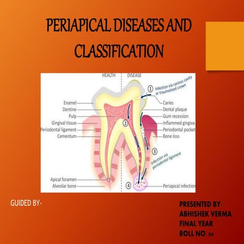 Endodontic Emergencies | PPTX