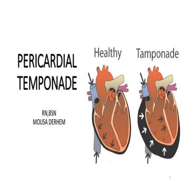 PERICARDIAL TEMPONADE drmousa.pptx