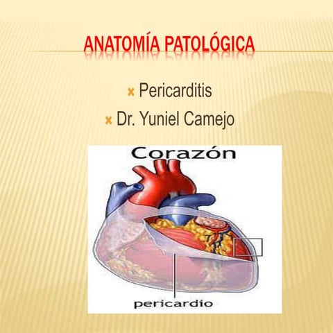 Pericarditis 
