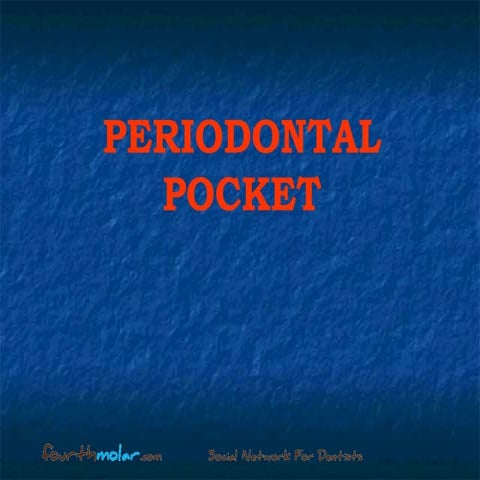 Peridontal-Pocket-Perio study guide exam