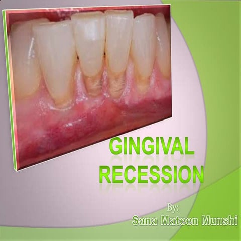 Gingival Recession