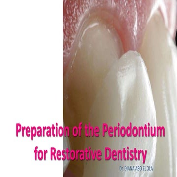 Perio resorative inter-relationship.