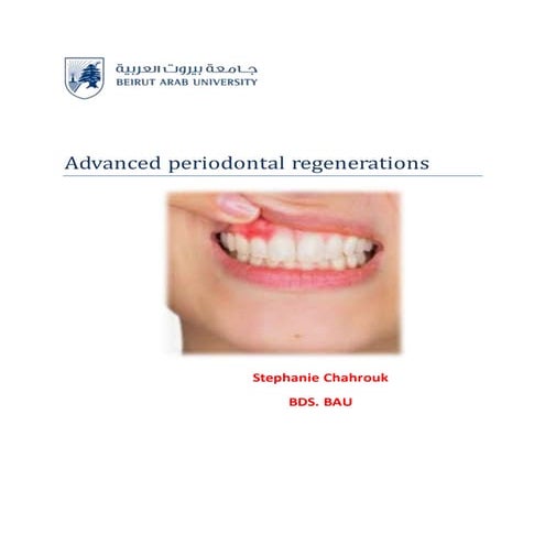 Advanced periodontal regenerations 
