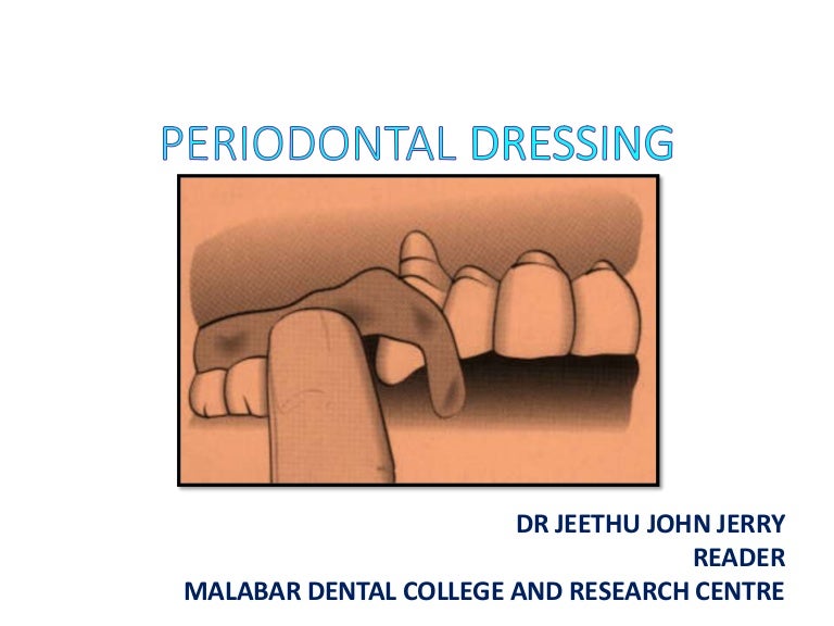 Periodontal dressings