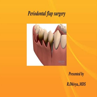 Periodontal flap surgery