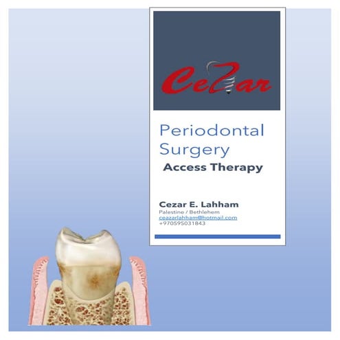 Periodontal surgery   cezar pdf