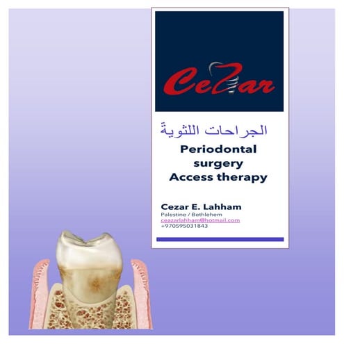 Periodontal surgery dentist cezarجراحة اللثة بالعربية 