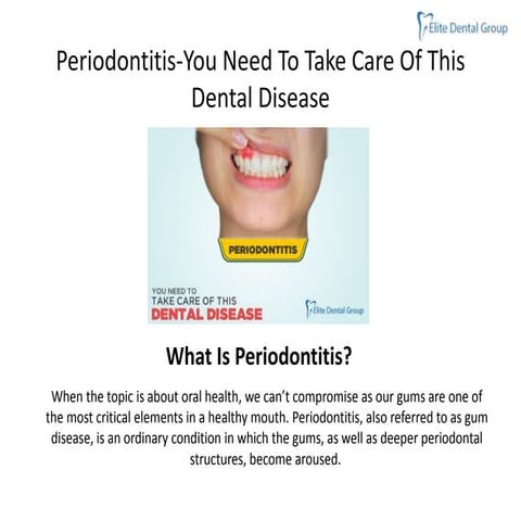 Periodontitis (Gum Disease) Symptoms, Stages & Treatment.pptx