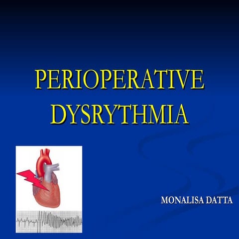 PERIOPERATIVE CARDIAC DYSRYTHMIA.ppt 222t
