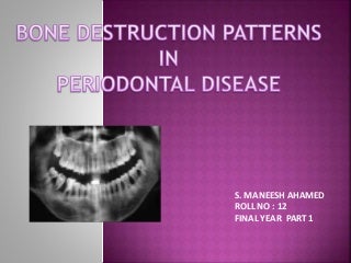 Patterns of bone destruction in periodontics