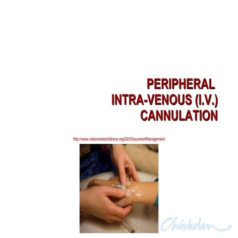 Peripheral Iv Cannulation