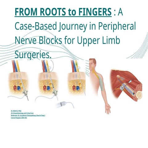 Peripheral nerve blocks 1 by dr.mushtaq | PPTX