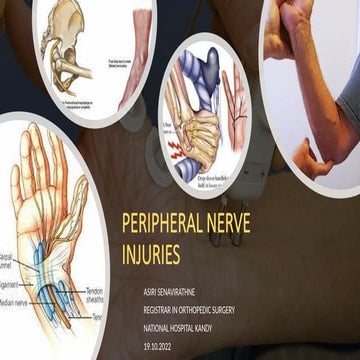 Nerve repair and grafting | PPTX