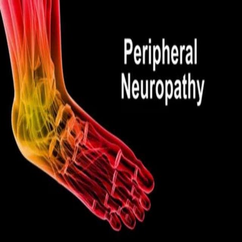 Peripheral Neuropathy