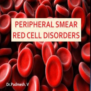 Peripheral smear..RBC disorders.. D...