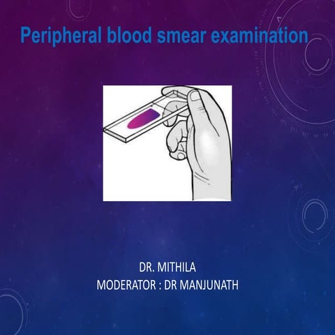 Peripheral smear 