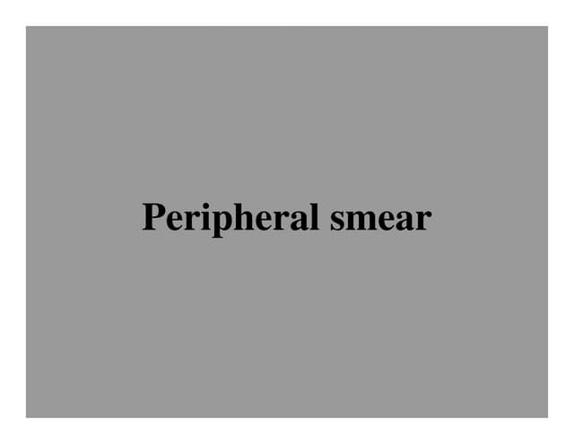 Peripheral Smear Using Leishman Stain