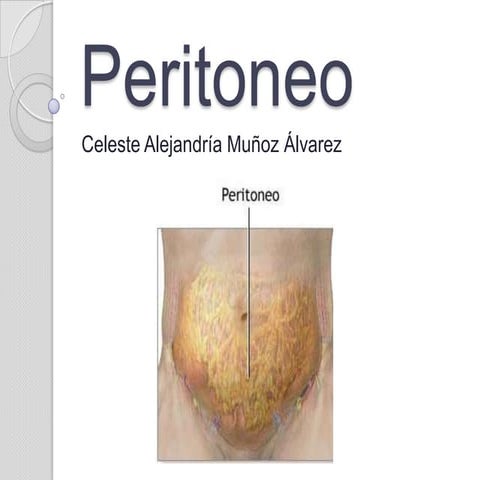 Peritoneo