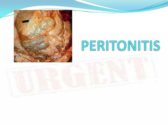 Peritonitis