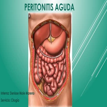 Semiología de Peritonitis - Univ. Wiener | PPTX