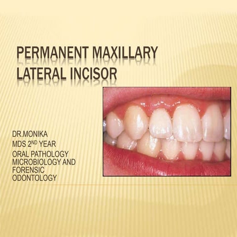 Permanent Maxillary Lateral Incisor