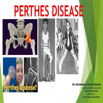 Perthes ’ disease | PPT
