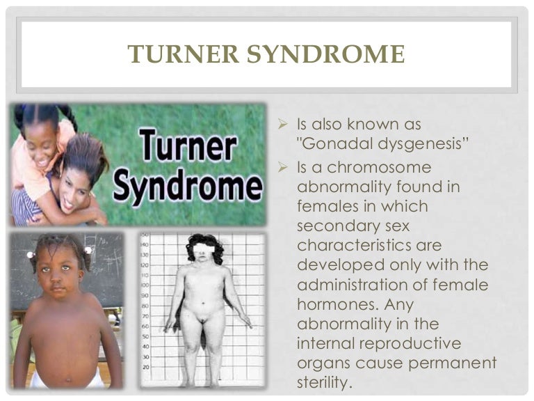 Pervasive developmental disorders (turner syndrome, klinefelter's syn…