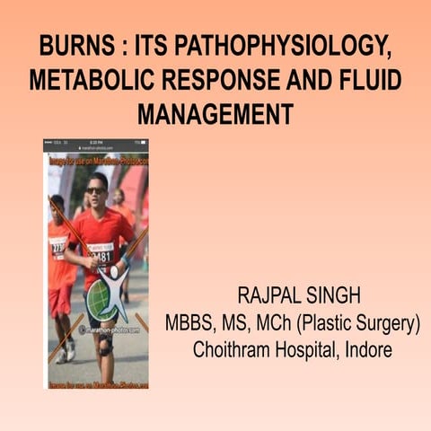 BURNS-its pathophysiology, fluid management and its surgical management basics