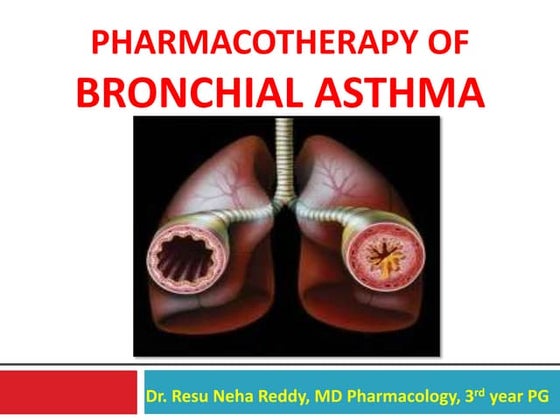 Bronchial Asthma cause and symptoms and uses. | PPT