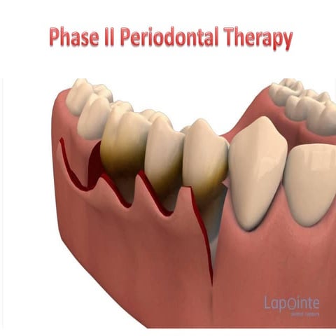 Phase II periodontal therapy
