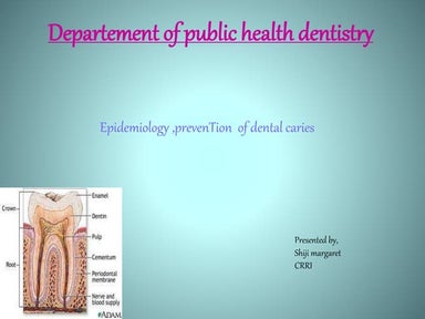 Epidemiology and prevention of Dental caries