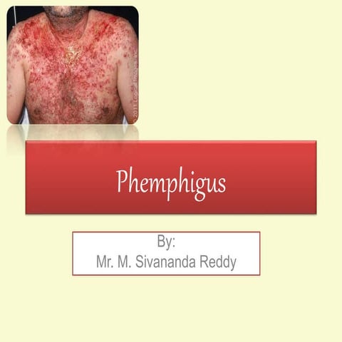 Phemphigus