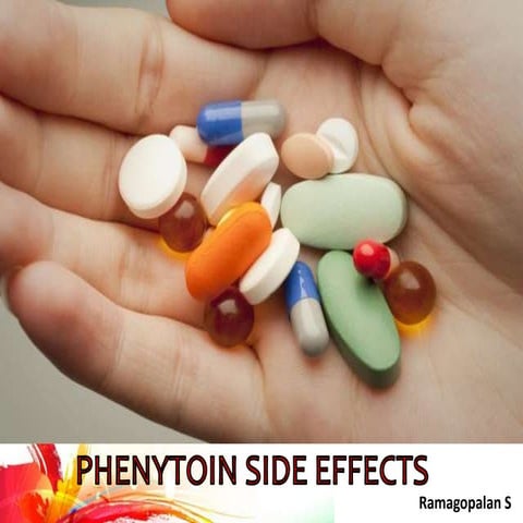 Adverse effect of Phenytoin 