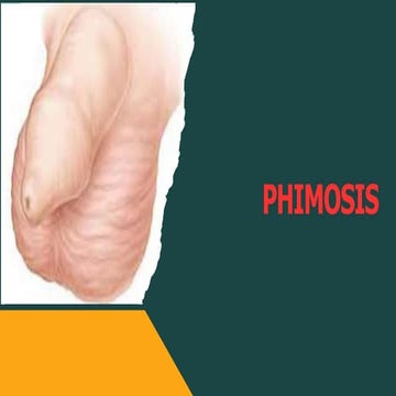 PHIMOSIS PARAPHIMOSIS 