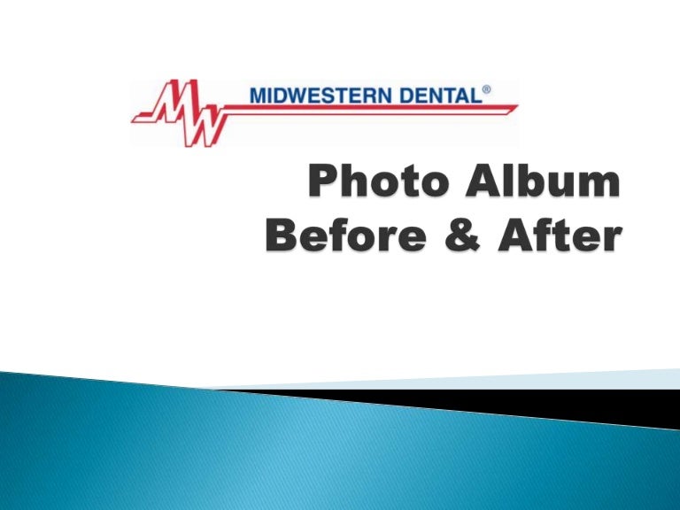 Before and After