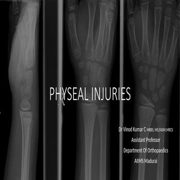 Physeal injuries - cause , clinical features and management