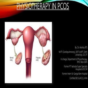 Physiotherapy in pcos