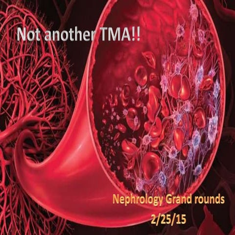 Thrombotic Microangiopathy associated with proteasome inhibitors